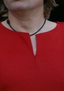 Bild1
